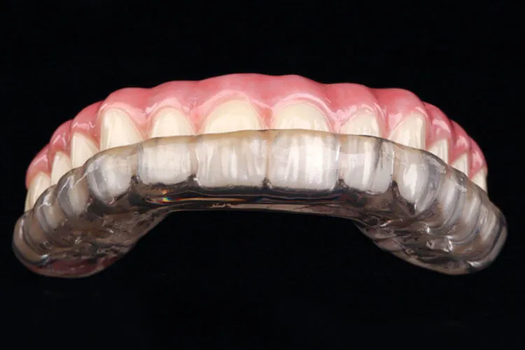 Night Guards for Teeth Grinding